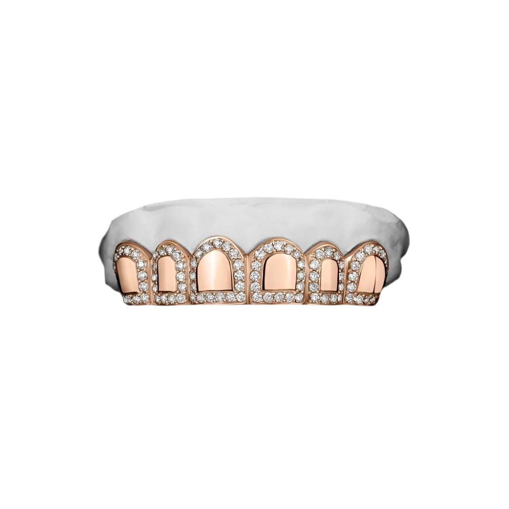 Roman pillar Moissanite Grillz